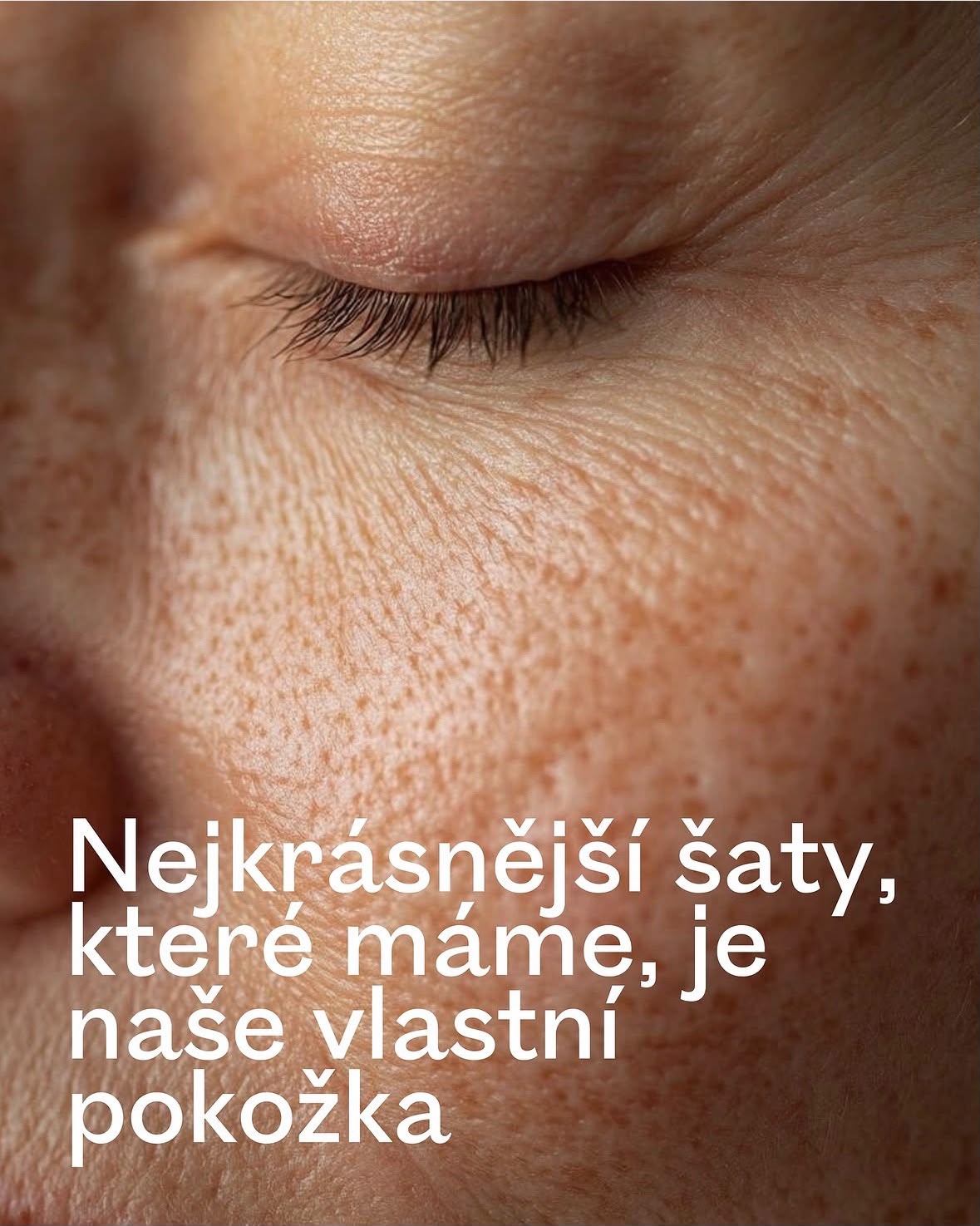 Close-up skin campaign — Nejkrásnější šaty, které máme, je naše vlastní pokožka